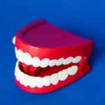 7 Bahaya Gigi Berlubang Ini Sering Kita Sepelekan Loh 7 kotabanjarmasindotcom